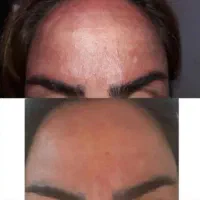 اگه مشکل خاصی داری بگو تا بگم چیکار کنی