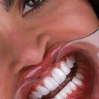 جشنواره کامپوزیت لمینیت روکش عصب ونیر بریدج ترمیم|خدمات آرایشگری و زیبایی|تهران, هفت حوض|دیوار