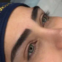 کاشت ابرو با طراحی و اسکن سه بعدی در اسمارت بیوتی