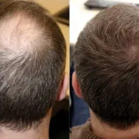 گیاهی و ارگانیک رویش انجام میشه