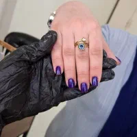 تخفیف ویژه کاشت و ترمیم ناخن