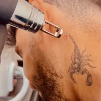 فرصت استثنایی برای ریمو تتو،با تخفیف ویژه