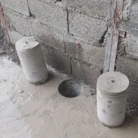 کاشت بولت وکرگیری