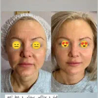 کارشناس جذب و پذیرش مراجع مطب زیبایی. CRM