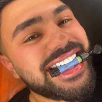 کامپوزیت فقط و فقط از دم قسط