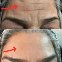 کرم ضد چروک جایگزین قطعی بوتاکس و ژل بدون بازگشت|آرایشی، بهداشتی، درمانی|تهران, شیخ هادی|دیوار