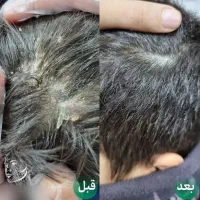 درمان رشک و شپش زیر نظر استاد حرفه ای|خدمات آرایشگری و زیبایی|قم, نیروگاه|دیوار