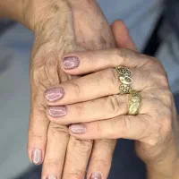 ترمیم ناخن ۴۵۰ کاشت ۶۰۰