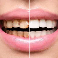 منشی و‌دستیار دندانپزکی