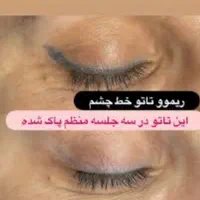 اجرا و حذف تتو|خدمات آرایشگری و زیبایی|شیراز, مسلم|دیوار