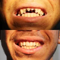 تخفیفات ویژه دندانپزشکی(عصب کشی،پرکردن،کشیدن،جراحی|خدمات آرایشگری و زیبایی|شیراز, قصرالدشت|دیوار