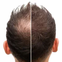دیگه نگران موهات نباش.