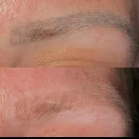 لیزر تتو های قدیمی تتوی صورت و بدن فقط ۵۰۰|خدمات آرایشگری و زیبایی|فولادشهر, C3|دیوار