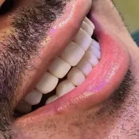 دندانپزشکی درمانی و زیبایی(نقدواقساط)