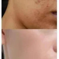 کرم اماراتی vip|آرایشی، بهداشتی، درمانی|جیرفت, |دیوار