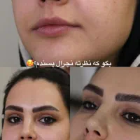 تزریق بوتاکس و فیلر و انزیم و پی ارپی وانواع نخ ها|خدمات آرایشگری و زیبایی|مشهد, رضاشهر|دیوار