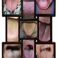 زبان شناسی و درمان رایگان