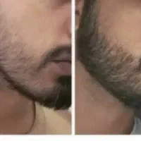 با این سرم تو دو ماه درش بیار