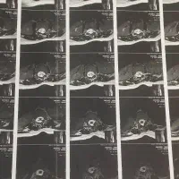 متخصص مغز و اعصاب و ستون فقرات