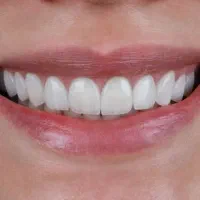 به یک دستیار دندانپزشک نیازمندیم