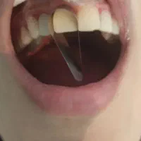 دندانپزشکی در خرم آباد با تخفیف ویژه|خدمات آرایشگری و زیبایی|دورود, |دیوار