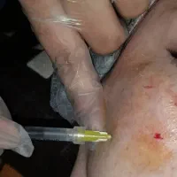 خدمات و آموزش فیشیال مزوتراپی میکروندلینگ|خدمات آرایشگری و زیبایی|اهواز, حصیرآباد|دیوار