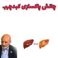 درمان کبد چرب
