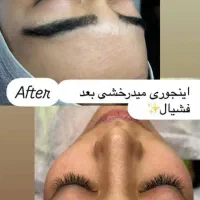 کلینیک تزریق فیلر بوتاکس لیزر هایفو فشیال مزو خال|خدمات آرایشگری و زیبایی|تهران, نیروی هوایی (پیروزی)|دیوار
