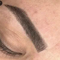 میکرو بلیدینگ وشیدلب