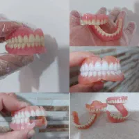 دندان متحرک مصنوعی بقیمت سنندج۶/۵ زرین آباد ایجرود