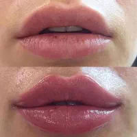 مرکز مجهز زیبایی لیزر تزریق ژل بوتاکس لاغری