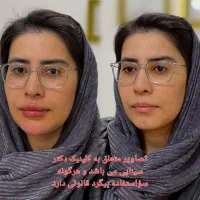 تزریق ژل و بوتاکس و لیزر در مطمئن ترین کلینیک مشهد|خدمات آرایشگری و زیبایی|مشهد, احمدآباد|دیوار