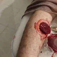 حجامت ماساژ