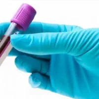 استخدام نمونه گیر سیار