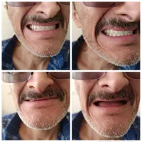 دندانسازی . دندان مصنوعی|خدمات آرایشگری و زیبایی|شیراز, سینما سعدی|دیوار