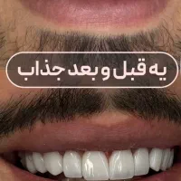 جشنواره کامپوزیت از ۵۹۰|خدمات آرایشگری و زیبایی|اهواز, کیانپارس |دیوار