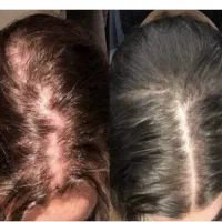 مزوژل جوانساز پوستتو جوان کن prp۹۸۰|خدمات زیبایی و سلامت|اصفهان, بهار آزادی|دیوار