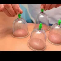 چکاپ کلی خدمات طب سنتی حجامت زالو بادکش فصد|خدمات آرایشگری و زیبایی|اصفهان, برازنده|دیوار