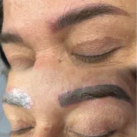 ریموو تک جلسه ای تتو