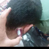 حجامت با حوصله و با دقت بصورت سیار