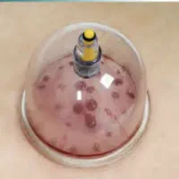 تزریقات، وحجامت