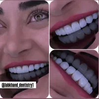 کامپوزیت تخصصی با طراحی طبیعی و اصولی