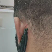 طب سنتی سیاتیک کمر درد دیسک بادکش حجامت زالو فصد|خدمات آرایشگری و زیبایی|ملارد, |دیوار
