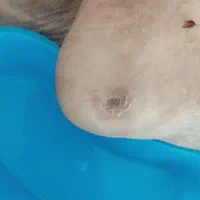 کارشناس زخم/خدمات تخصصی پرستاری در منزل|خدمات آرایشگری و زیبایی|اصفهان, شهید رجایی|دیوار