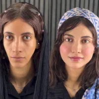 تخفیفات استثنایی ژل و بوتاکس در مطب زیبایی|خدمات آرایشگری و زیبایی|قم, زنبیل آباد|دیوار