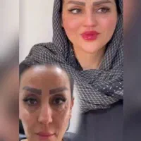 فیلربادی۱۵۰مزو،بوتاکس،انزیم.فول فیس،فیلر۵۵۰|خدمات زیبایی و سلامت|کرج, گوهردشت|دیوار