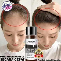 روغن رفع کچلی میخوای کچل نشی بزن|آرایشی، بهداشتی، درمانی|بومهن, |دیوار