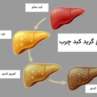 علائم کبدی جدی بگیرد