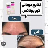 کرم ضدچین وچروک صورت گاتیو ۴۰mL|آرایشی، بهداشتی، درمانی|ساری, |دیوار