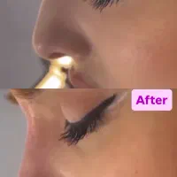 تزریق ژل وبوتاکس تخفیف ویژه|خدمات آرایشگری و زیبایی|تهران, خانی آباد نو شمالی|دیوار